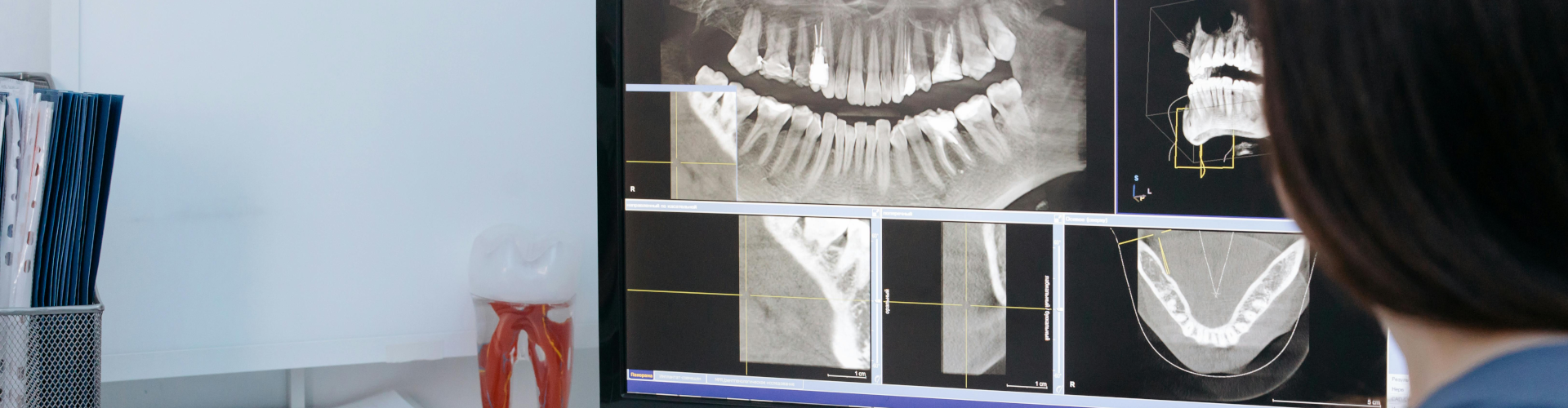 FOGÁSZATI RÖNTGEN FOGÁSZATI RÖNTGEN