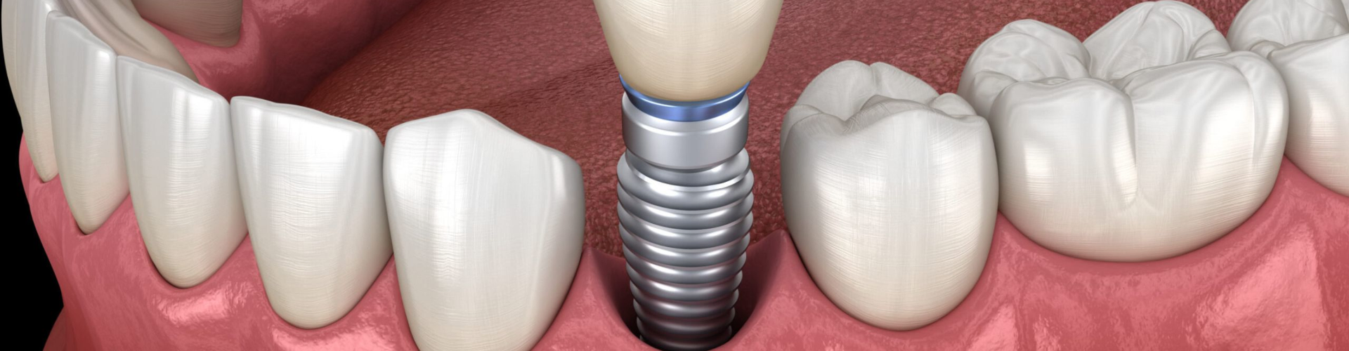 általános fogászat általános fogászati ellátás